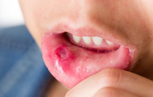 ���������׌�(d��o)�¿�ǻ���� ���t(y��)ƫ�����ί���ǻ����