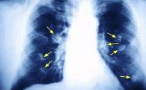 �������l(f��)Ů�Էΰ��������?zh��n)?�N���͟���Σ����������