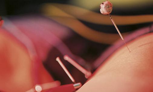 ᘾĜp������Щ�ʳע�����(xi��ng)