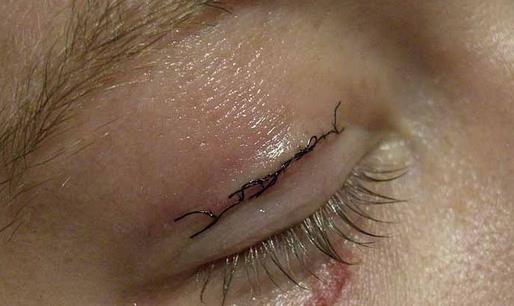 ������m�����p��Ƥ�g(sh��)��