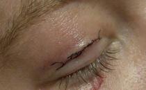 ������m�����p��Ƥ�g(sh��)��