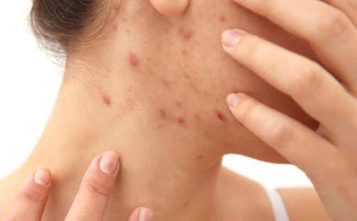 Ƥ���p�ɽ�Q����