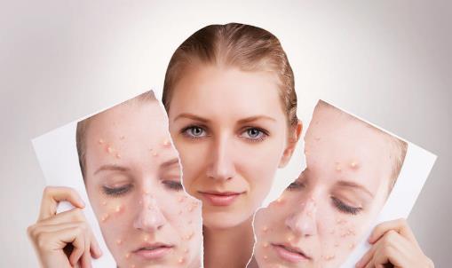 �A(y��)���ഺ����4��(g��)����