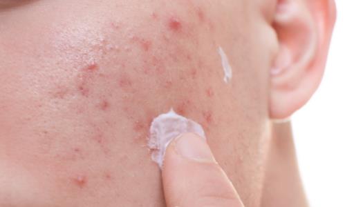 �������ԔD�� ��ʲô���L����