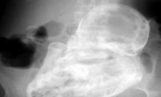 ̫������82�q��̫̫���������40��