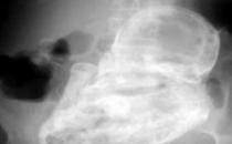 ̫������82�q��̫̫���������40��