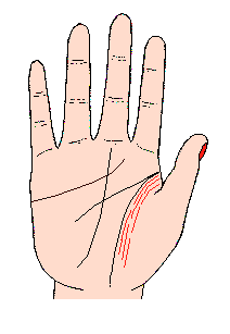 ����Ӱ푾���Ӱ푾��D�⣬����Ӱ푾������D��