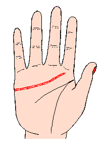 ���龀�D�⣺���龀�^�L