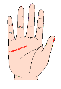 ���龀�D�⣺���龀��