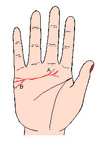 �ĸ��龀���������֧��