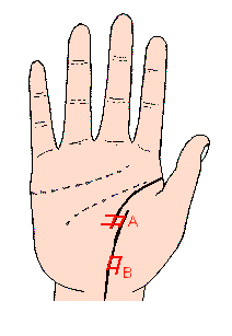 �����������D��