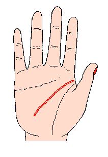 �ǻ۾��D�⣺�^�X���ɞ�朠�